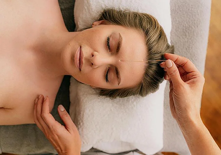 Acupuncture à la Boutique Bien-être.