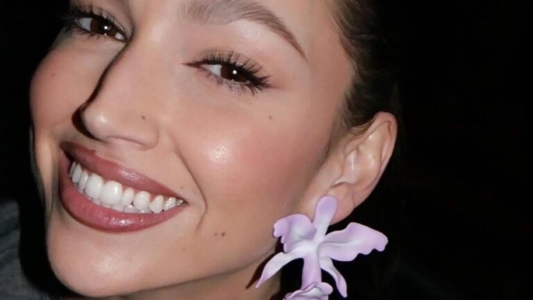 Adieu les appareils dentaires métalliques : un sourire parfait avec ces avancées en orthodontie